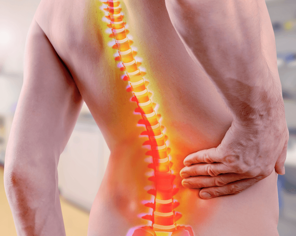 Fisioterapia para coluna em Jundiaí com avaliação individualizada na ITC Vertebral Jundiaí.