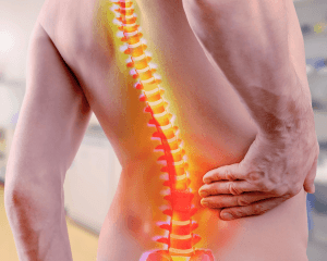 Fisioterapia para coluna em Jundiaí com avaliação individualizada na ITC Vertebral Jundiaí.