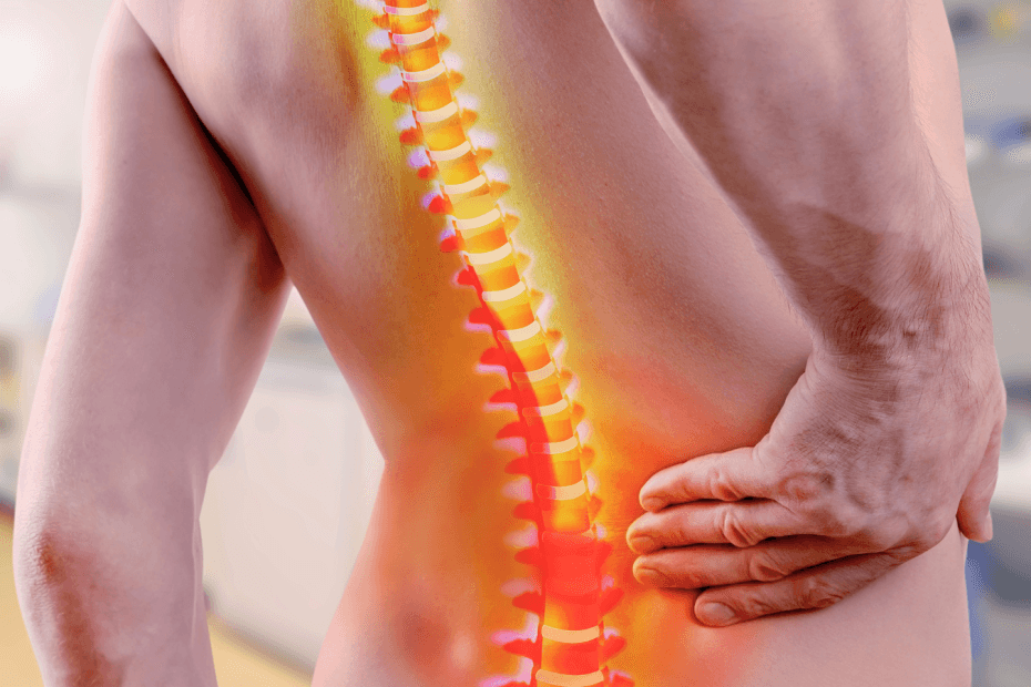 Fisioterapia para coluna em Jundiaí com avaliação individualizada na ITC Vertebral Jundiaí.
